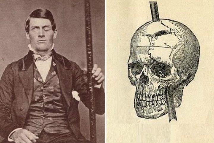 phineas gage