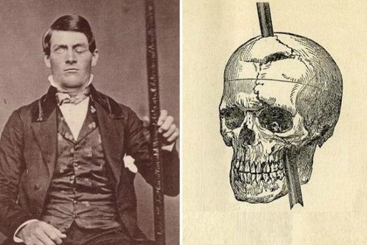 Phineas Gage: el oscuro cambio de identidad | CO 27-01-26